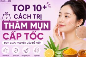 Top 10+ cách trị thâm mụn cấp tốc đơn giản, nguyên liệu dễ kiếm
